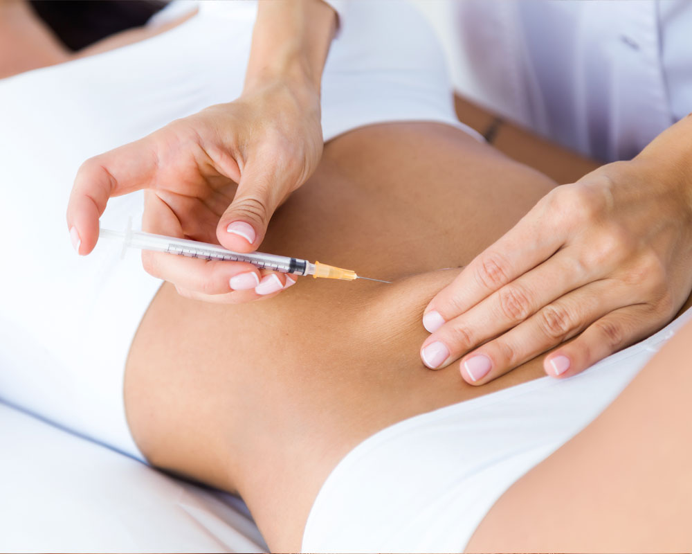 Lipoliz Mezoterapileri